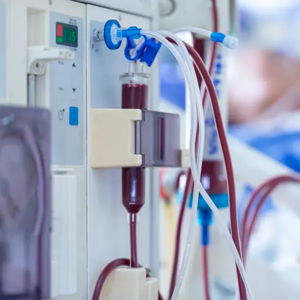 Close-up of dialysis treatment equipment, including tubing and a monitoring chamber
