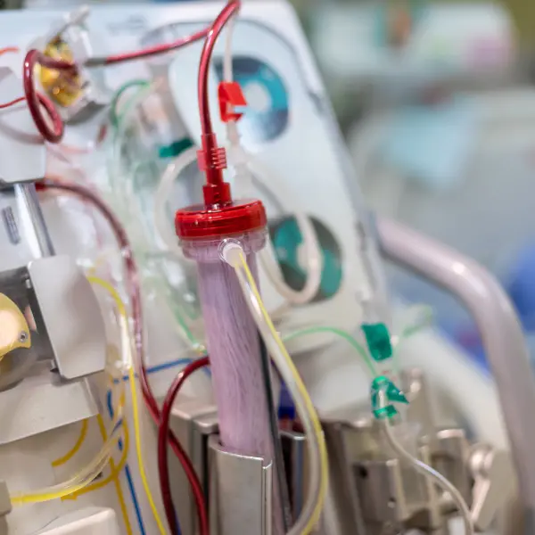 Dialysis filter and red treatment tubing attached to a hemodialysis machine