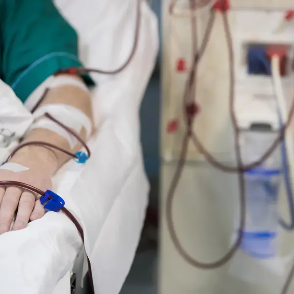 Patient's arm resting by blood tubing during dialysis treatment