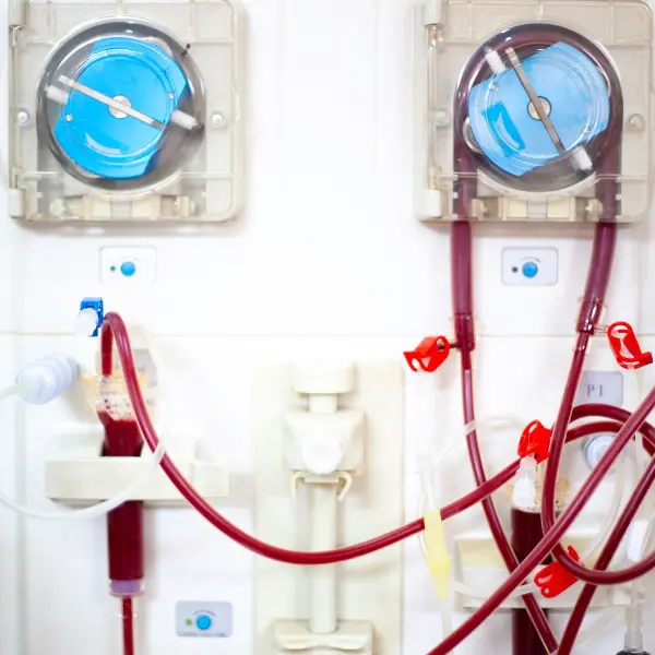 Close-up of dialysis machine with blue circular pumps and red blood tubing